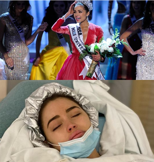 Former Miss USA Undergoes Surgery for Endometriosis