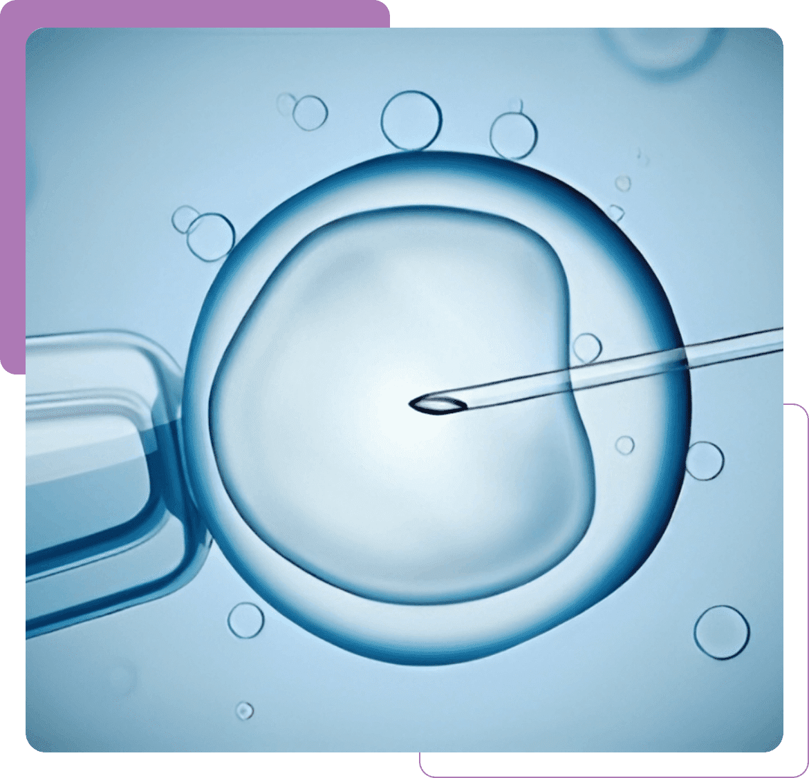 ICSI sperm injection into human egg