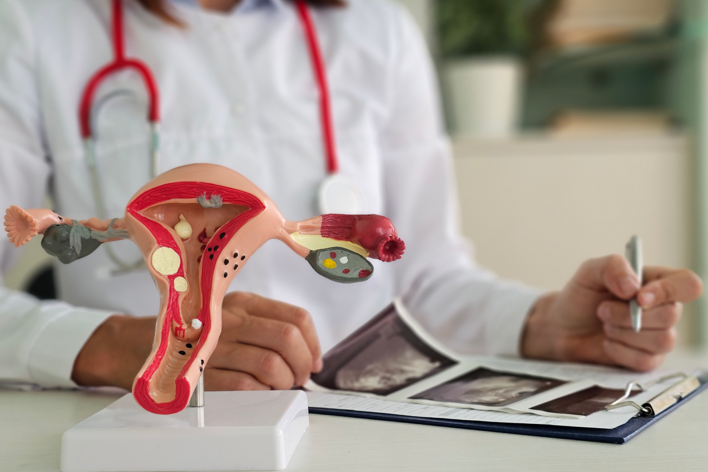 Gynecologist with uterine model and ultrasound images